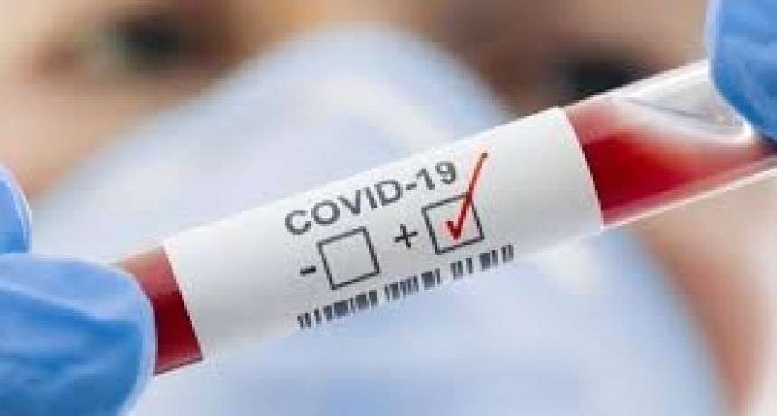  13.667 personas fueron diagnosticadas con coronavirus en el pa&iacute;s