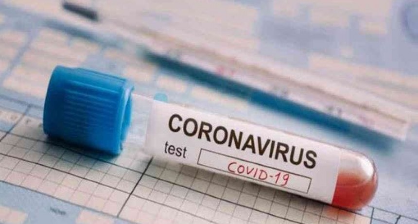 COVID-19: En las &uacute;ltimas 24 horas, se registraron 11.249 casos en el pais.