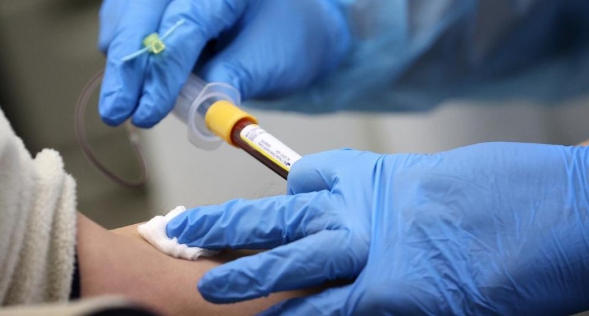 COVID-19: Argentina super&oacute; las 30.000 muertes